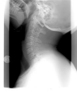 neck bones x-ray scan